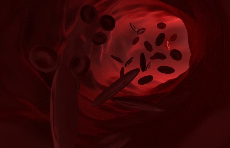 Blood vessel in Cycles preview image 1
